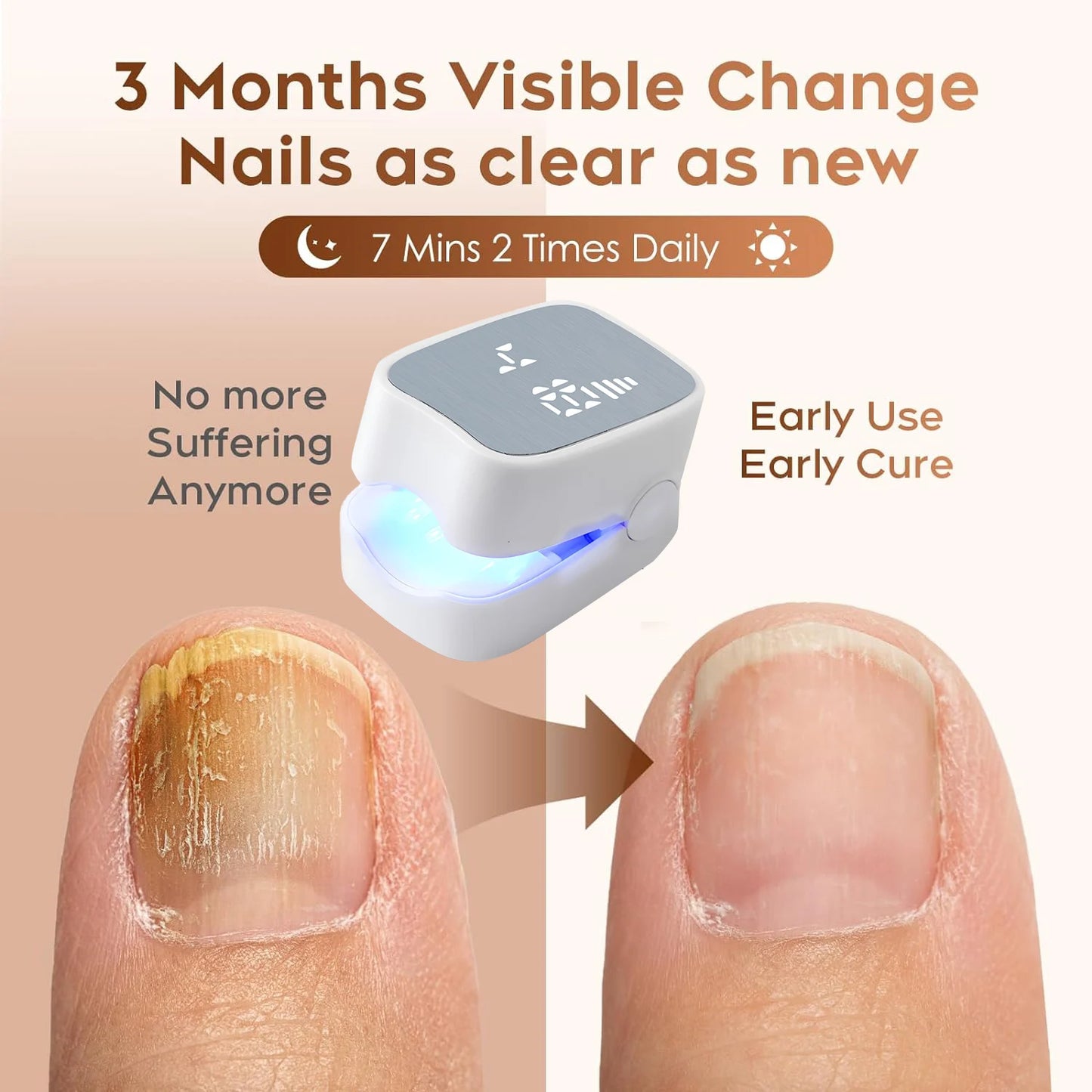 Dermoré™ – Pro Nail Fungus Laser Device